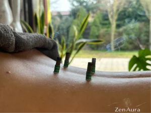 Moksoterapia odcinka ledźwiowego – minimoksa (małe cygara moksowe) przyklejone na plecach pacjenta w gabinecie ZenAura