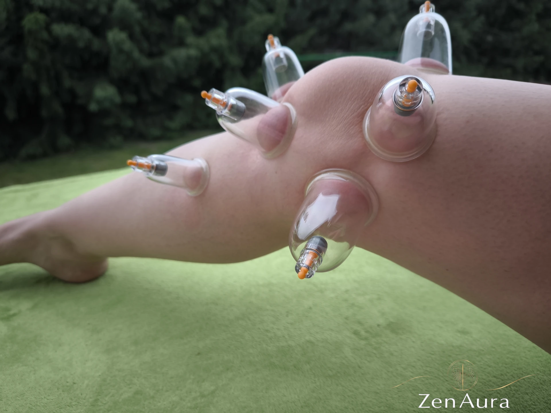 Terapia próżniowa kontuzji kolana – bańki bezogniowe w plenerze przez terapeutkę ZenAura